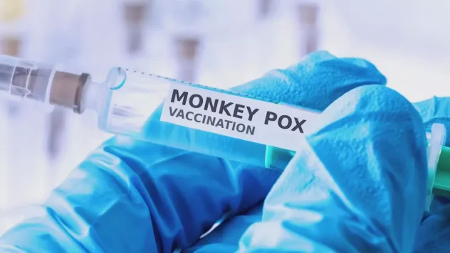 Sağlık Bakanlığı, 'maymun çiçeği virüsü' rehberi yayımladı